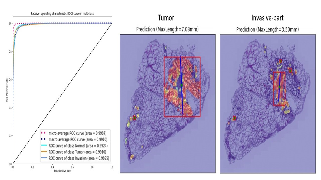組織病理分類器測試(Patch-level test; N=21)、可視化和腫瘤最大徑量測